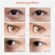 Under Eye Patches - 30 Pairs Collagen Eye Mask Eye Patches for Puffy Eyes and Dark Circles, Anti Aging Moisturizing Gel Ey...