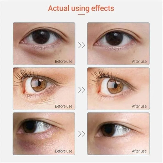Under Eye Patches - 30 Pairs Collagen Eye Mask Eye Patches for Puffy Eyes and Dark Circles, Anti Aging Moisturizing Gel Ey...