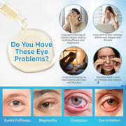 Eye Serum For Chalazion & Blepharitis Treatment, 2 PCS Chalazion Remover For Eyelid Treatment, Eyelid Serum With Avocado O...