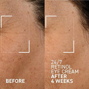 Dr. Brandt Bright This Way 24/7 Retinol Eye Cream - 0.5 oz, Pack of 2 - Smooths the Look of Fine Lines & Wrinkles, Illumin...