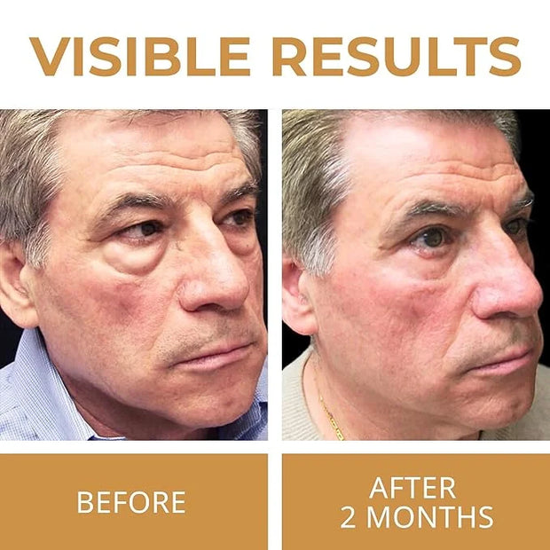 ABERA Natural Repair Eye Cream with Set 15 Eye Masks, Minimizes Under Eye Bags & Dark Circles, Reduce Puffiness, Wrinkles ...