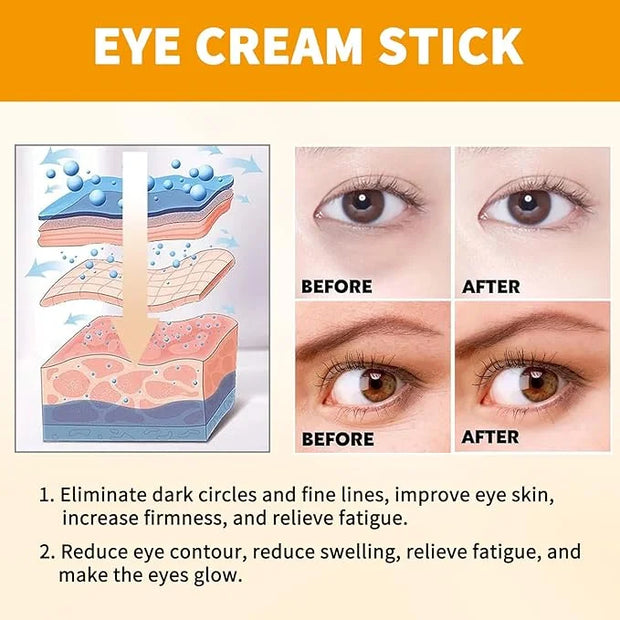 Vitamin C Eye Cream Puffiness Remover Eye Serum Anti-aging & Moisturising Vitamin C Eye Serum Eye Bags Treatment for Men a...