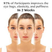 Eye Cream Roller, Collagen & Peptides for Total Eye Lift, Rapid Wrinkle Repair, Dark Circle & Under Eye Bag Treatment, Ant...
