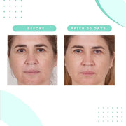 Serious Skincare Glycolic Skin Renewal Set - Retexturizing Serum - Facial Moisture Cream - Face Wash Cleanser - Balancing ...
