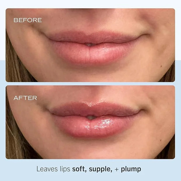 First Aid Beauty - Ultra Repair Lip Balm, Instant Hydration and Moisture for Soft, Supple & Plump Lips, Concentrated Formu...