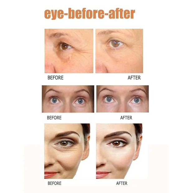 2Pack Instant Temporary Eye Cream Set,Visuasource 1ml Eye Tightening Serum Quickly Firming Reduces Under-eye puffiness,Dar...