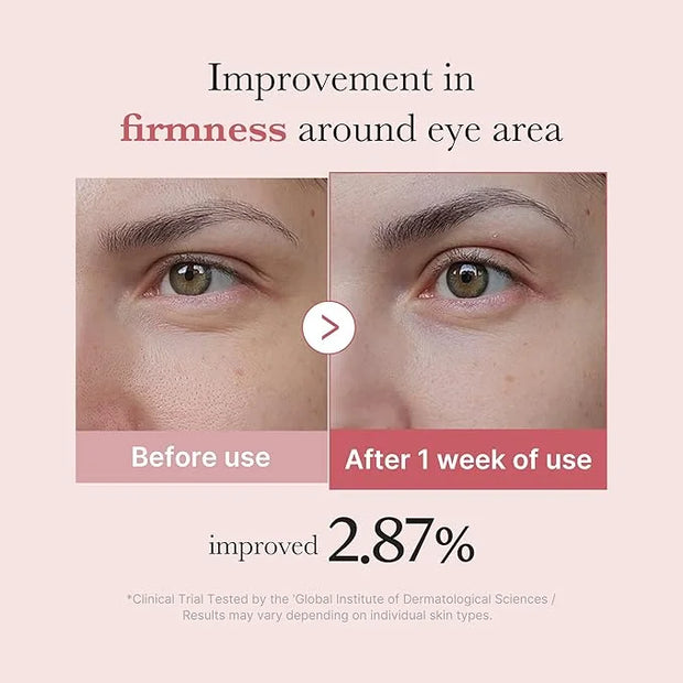 medicube Salmon DNA PDRN Pink Peptide Eye Serum with Niacinamide and 99% Purity Retinol for Fine Lines, Uneven Skin Tone, ...