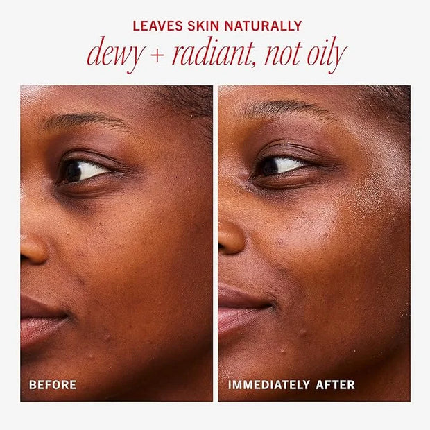 First Aid Beauty - Hydrating Dewy Gel Cream, Lightweight Oil-Free Facial Moisturizer with Hyaluronic Acid and Ceramides, H...