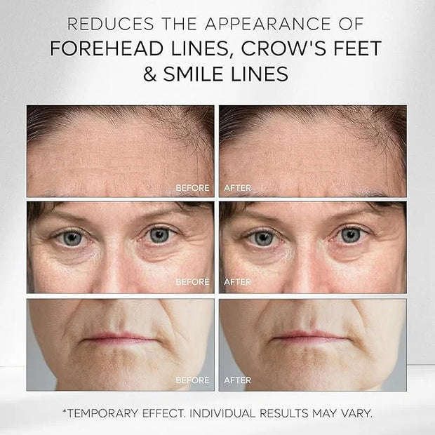 Instant Rapid Face Lift Cream: Temporary Eye Tightener Instant Wrinkle Remover For Face Instant Firming Eye Cream Instant ...