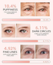 Dr. Pure Under Eye Patches for Puffiness: Dark Circles and Puffy Eyes Treatment Caffeine Eye Mask with Niacinamide Hyaluro...