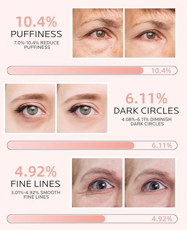 Dr. Pure Under Eye Patches for Puffiness: Dark Circles and Puffy Eyes Treatment Caffeine Eye Mask with Niacinamide Hyaluro...