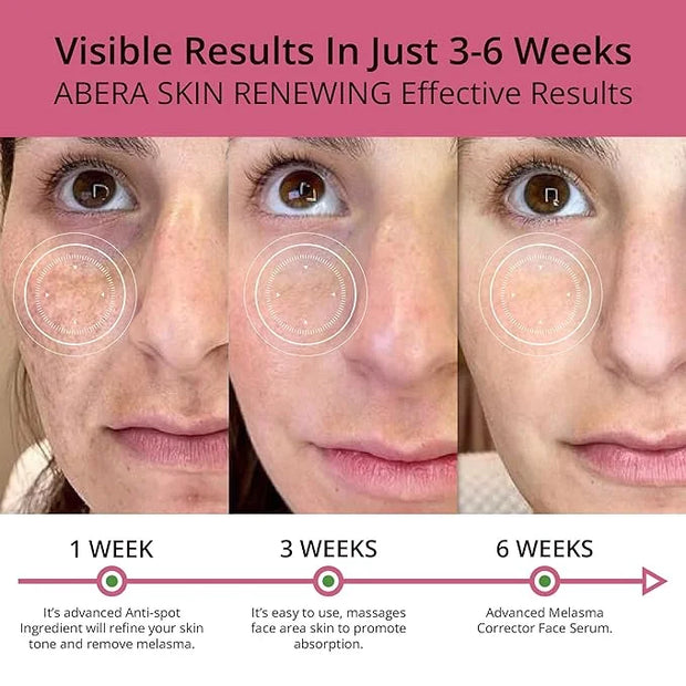 Combo Abera Saffron Serum For Melasma Treatment & Abera Eye Roller Serum With Mint For Dark Circles and Puffiness - Produc...