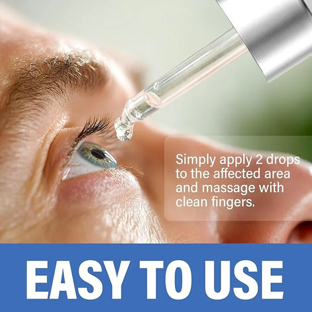 ITECFREELY Stye Eye Treatment, Natural Stye Eye Relief Drops Serum for Styes Chalazion and Blepharitis, Fast Chalazion Rem...