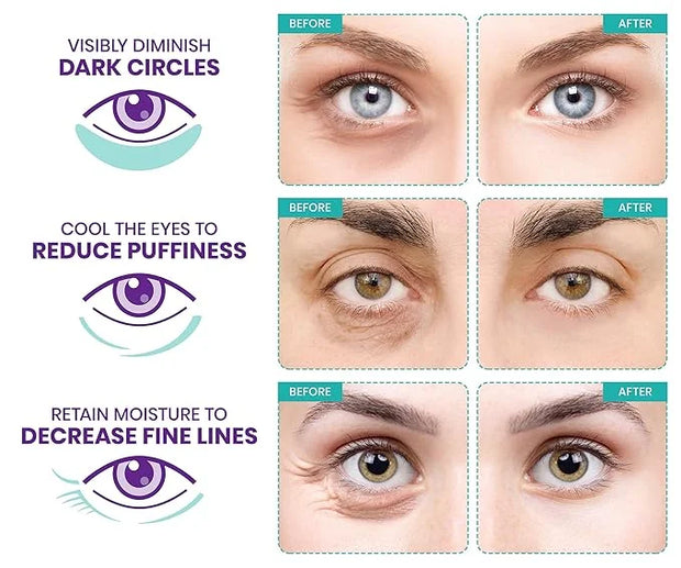 Stylia Under Eye Patches for Puffy Eyes and Dark Circles (6 Pairs) - Marine Collagen Under Eye Mask with Retinol, Vitamin ...