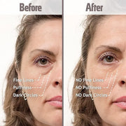 Puffy Eye Treatment Instant results – Naturally Eliminate Wrinkles, Puffiness, Dark Circle and Bags in Minutes – Hydrating...
