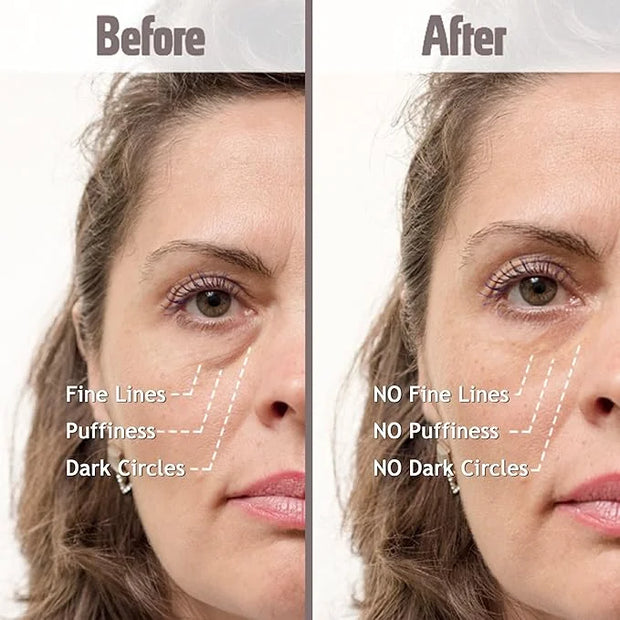 Puffy Eye Treatment Instant results – Naturally Eliminate Wrinkles, Puffiness, Dark Circle and Bags in Minutes – Hydrating...