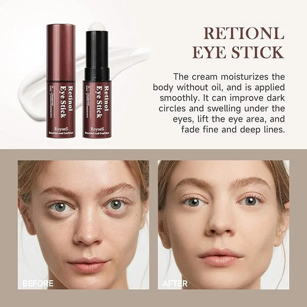 AKARY Retinol Eye Cream for Dark Circles and Puffiness, Skincare Under Eye Cream Eye Stick Reduce Wrinkles and Fine Lines,...