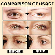 Eye Serum Stick, Stick For Under Eye Bags, Eyebalm,Deeply Moisturizes,Reduce Fine Lines (3pcs) - Product Image