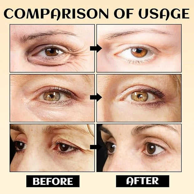 Eye Serum Stick, Stick For Under Eye Bags, Eyebalm,Deeply Moisturizes,Reduce Fine Lines (3pcs) - Product Image