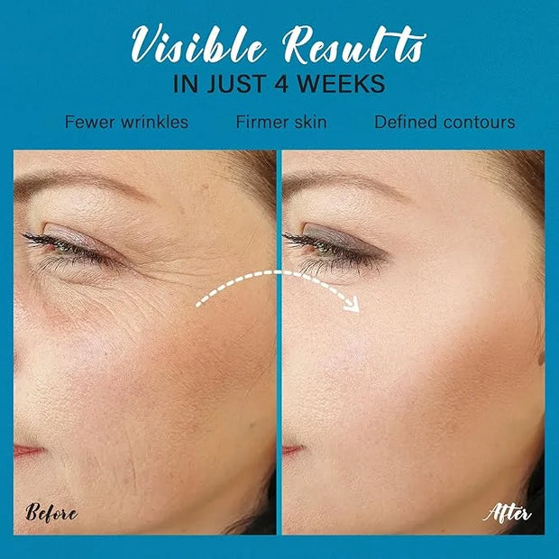 Skin Tighten And Lift Neck Cream: Face Lift Cream 6-in-1 Anti-Aging Moisturizer for Anti Wrinkle - Hydrating Neck Firming ...