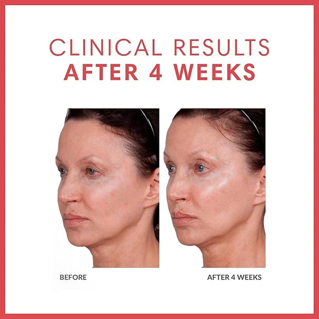 Consult Beaute Volumagen TRIO Skin Care For Plumper & Smoother Skin - Collagen, Hyaluronic Acid and Ceramides - Doctor For...