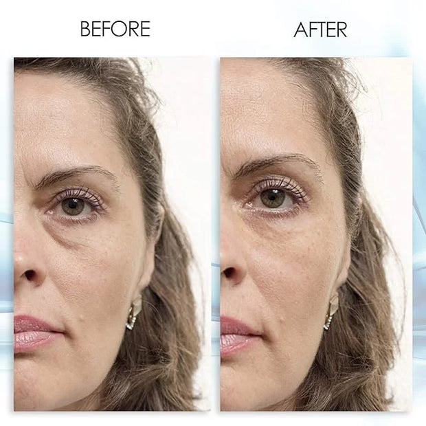 Puffy eye gel instant results