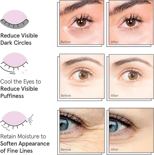 Under Eye Mask - Reduce Dark Circles, Puffy Eyes, Undereye Bags, Wrinkles - Gel Under Eye Patches, Vegan Cruelty-Free Self...