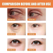 3pcs Revive + Glow Vitamin C Eye Balm, Revive and Glow Vitamin C Eye Balm, Hydrating Eyes Cream, Improve Dark Circles, Red...