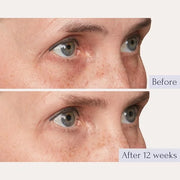 Tru Alchemy Eye Elixir Cooling Eye Treatment Cream - Dark Circle Eye Cream for Puffiness and Bags Under Eyes - Caffeine, H...