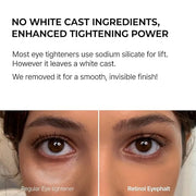 Retinol Eyebag Cream for Puffiness, Dark Circles & Fine Lines, Wrinkle, EGF Anti-Aging Under Eye Moisturizer with Niacinam...