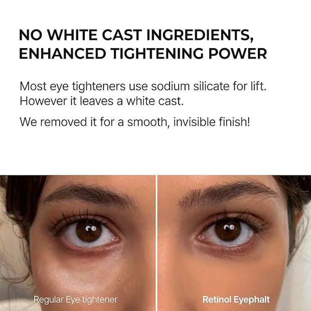 Retinol Eyebag Cream for Puffiness, Dark Circles & Fine Lines, Wrinkle, EGF Anti-Aging Under Eye Moisturizer with Niacinam...