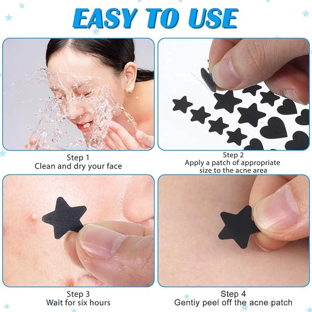 288pcs Pimple Patch Star, 2 Styles Star Pimple Patch, Cute Black Pimples Patches Stars, Skin-friendly, Breathable, Waterpr...