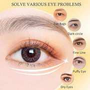24 Pairs Under Eye Patches for Puffy Eyes and Dark Circles, Collagen Under Eye Mask Skin Care Products, Snail Mucin Eye Pa...
