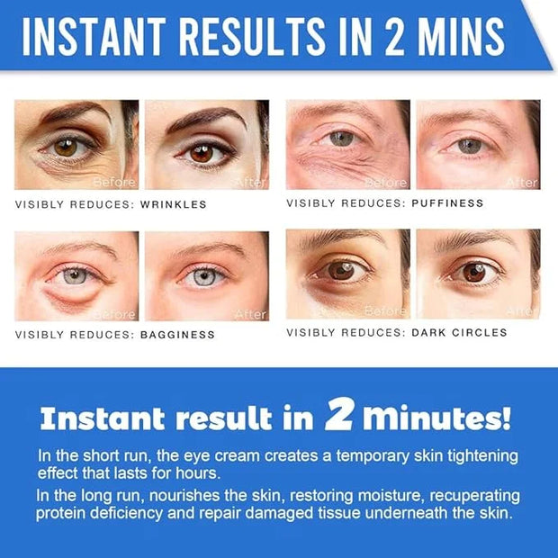 Revitalizing Eye Cream with Hyaluronic Acid, Caffeine, Green Tea - Anti-Wrinkle, Dark Circles,beauty,Firming, Puffiness, R...