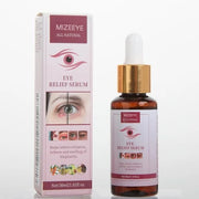 Chalazion Eye Treatment For Blepharitis, 2 PCS Moisturize Eyelids Serum and Chalazion Remover, Gentle Under Eye Relief Ser...