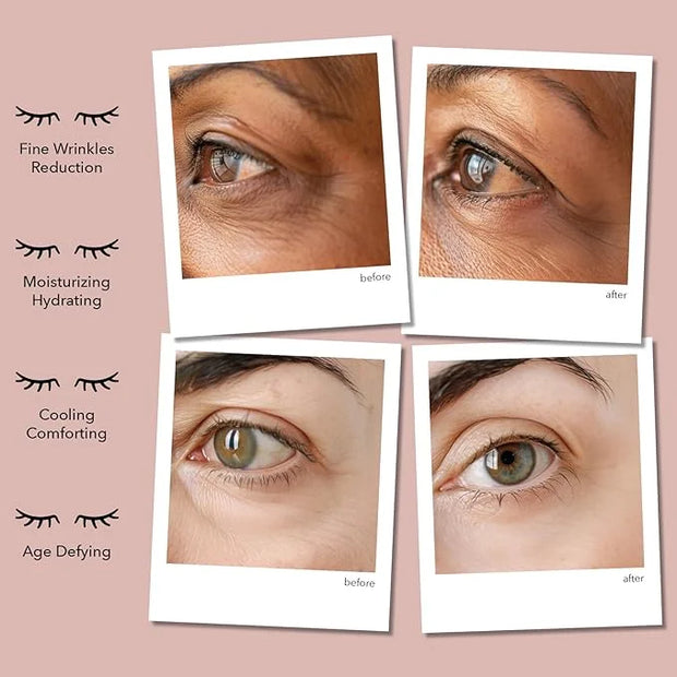 Anti-Wrinkle Under Eye Patches – Hydrating Eye Mask with Japanese Hydrophilic Gel Technology to Reduce Fine Lines, Moistur...