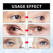 Berbax™ Eye Cream - Instant Tightening Eyelid Firming Cream for Anti-Aging Fine Lines & Under Eye Tightening - Product Image