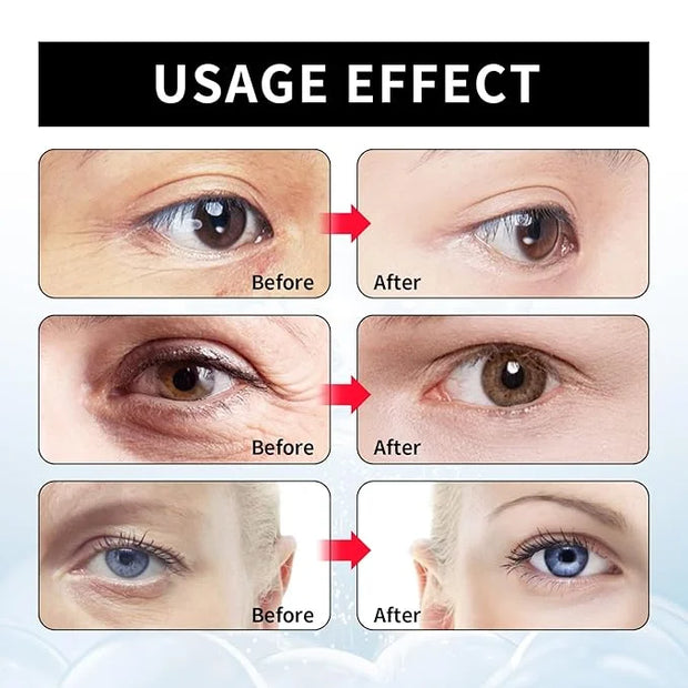Berbax™ Eye Cream - Instant Tightening Eyelid Firming Cream for Anti-Aging Fine Lines & Under Eye Tightening - Product Image