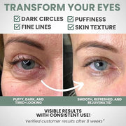 Under Eye Gel Cream – Reduces Dark Circles & Puffiness, Repairs & Moisturizes, Hydrating and Refreshing Formula for Under ...