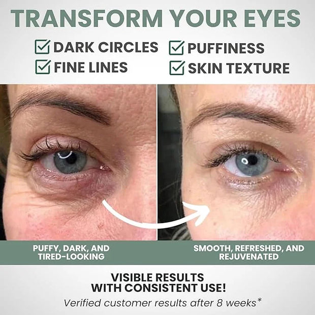 Under Eye Gel Cream – Reduces Dark Circles & Puffiness, Repairs & Moisturizes, Hydrating and Refreshing Formula for Under ...
