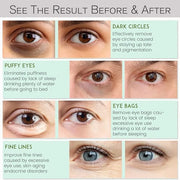 Under Eye Patches for Dark Circles and Puffiness - Under Eye Masks Anti-Aging Collagen Hyaluronic Acid, Reduce Dark Circle...