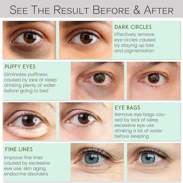 Under Eye Patches for Dark Circles and Puffiness - Under Eye Masks Anti-Aging Collagen Hyaluronic Acid, Reduce Dark Circle...