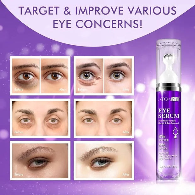 2 Packs Eye Serum for Dark Circles and Puffiness with 8% Caffeine 8% Retinol Hyaluronic Acid Niacinamide, Under Eye Cream ...