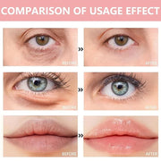 30 Pairs Lip Mask & Eye Mask,Under Eye Patches For Reducing Fine Lines & Dark Circles,Moisturizing Lip Spa Daily Labial Ma...