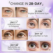 LANBENA Retinol Under Eye Patches for Dark Circles and Puffy Eyes, Cooling Eye Masks for Eye Bags, Fine Lines & Wrinkles R...
