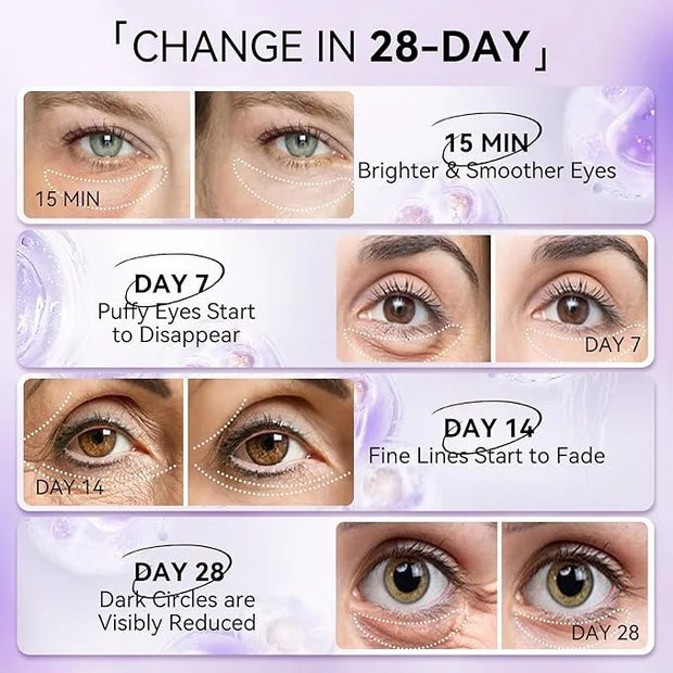 LANBENA Retinol Under Eye Patches for Dark Circles and Puffy Eyes, Cooling Eye Masks for Eye Bags, Fine Lines & Wrinkles R...