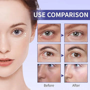 Retinol Under Eye Cream for Dark Circles and Under Eye Puffiness, Eye Repair Cream, 2 PCS Anti-Aging Hyaluronic Acid, Coll...