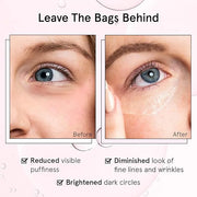 grace & stella Under Eye Brightener Roller - Travel Essentials - Retinol & Caffeine Eye Serum for Puffiness, Dark Circles,...