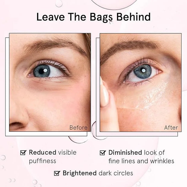 grace & stella Under Eye Brightener Roller - Travel Essentials - Retinol & Caffeine Eye Serum for Puffiness, Dark Circles,...