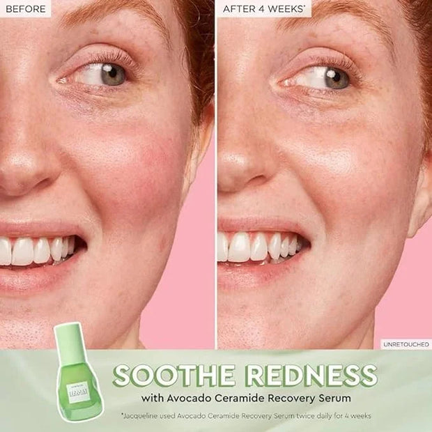 Glow Recipe Soothe, Glow & Bright Gift Set - Niacinamide Dew Drops Illuminating Primer & Avocado Ceramide Facial Serum & G...